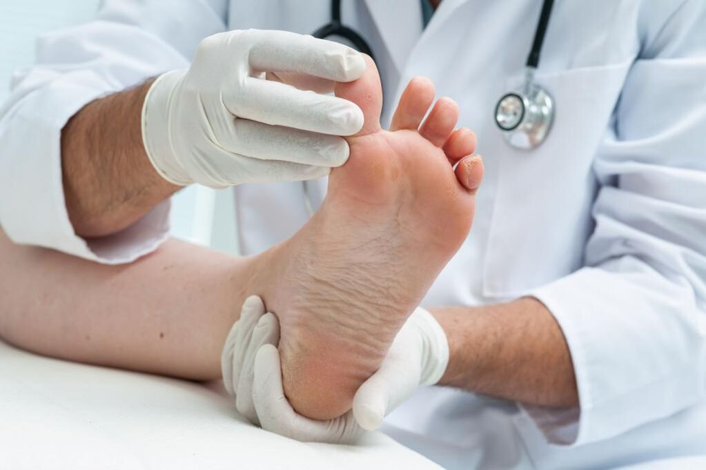 The doctor performs a diagnostic test on the leg affected by the fungus